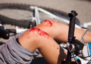 Injured biker